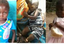 Malnutrition à Feshi : les enfants de moins de 5 ans gravement en danger